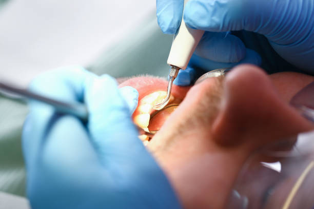 Best Broken Tooth Emergency  in Franklin, VA