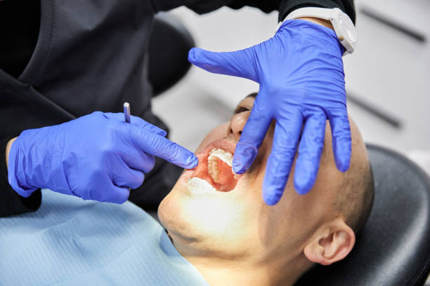 Best Dentist for Tooth Abscess  in Franklin, VA